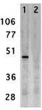 CD209 Molecule antibody, GTX31657, GeneTex, Western Blot image 