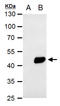 Pyruvate Dehydrogenase Kinase 1 antibody, GTX105999, GeneTex, Western Blot image 