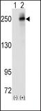 ALK Receptor Tyrosine Kinase antibody, PA5-14564, Invitrogen Antibodies, Western Blot image 