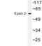 Epsin 2 antibody, LS-C177371, Lifespan Biosciences, Western Blot image 