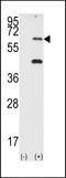 Eukaryotic Translation Initiation Factor 2 Alpha Kinase 2 antibody, LS-C101295, Lifespan Biosciences, Western Blot image 