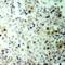 Cyclin Dependent Kinase 2 antibody, 79-165, ProSci, Immunohistochemistry paraffin image 