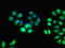 Interleukin 10 Receptor Subunit Alpha antibody, LS-C678298, Lifespan Biosciences, Immunofluorescence image 