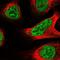 Bromodomain Containing 2 antibody, NBP1-84310, Novus Biologicals, Immunohistochemistry paraffin image 