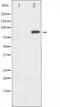 Glutamate Ionotropic Receptor AMPA Type Subunit 2 antibody, GTX52359, GeneTex, Western Blot image 
