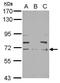 Neurofilament Light antibody, PA5-34650, Invitrogen Antibodies, Western Blot image 