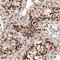 Chromobox 5 antibody, NBP1-89672, Novus Biologicals, Immunohistochemistry paraffin image 