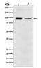 Eukaryotic Translation Elongation Factor 2 antibody, M00830-1, Boster Biological Technology, Western Blot image 