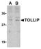 Toll Interacting Protein antibody, AP05245PU-N, Origene, Western Blot image 
