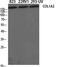 Collagen Type I Alpha 2 Chain antibody, PA5-50938, Invitrogen Antibodies, Western Blot image 