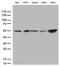 Inhibitor Of Nuclear Factor Kappa B Kinase Regulatory Subunit Gamma antibody, LS-C792995, Lifespan Biosciences, Western Blot image 