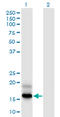 Prefoldin Subunit 4 antibody, LS-C197882, Lifespan Biosciences, Western Blot image 