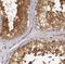 Component Of Inhibitor Of Nuclear Factor Kappa B Kinase Complex antibody, NBP1-89634, Novus Biologicals, Immunohistochemistry frozen image 