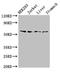 Tyrosine-protein kinase TXK antibody, LS-C679935, Lifespan Biosciences, Western Blot image 