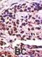 Ubiquitin Specific Peptidase 25 antibody, abx031555, Abbexa, Immunohistochemistry paraffin image 