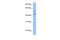 Programmed Cell Death 2 Like antibody, PA5-43621, Invitrogen Antibodies, Western Blot image 