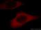 Thyroid Hormone Receptor Interactor 6 antibody, 21163-1-AP, Proteintech Group, Immunofluorescence image 