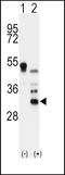 Apolipoprotein D antibody, LS-B10708, Lifespan Biosciences, Western Blot image 