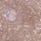 Poly [ADP-ribose] polymerase 3 antibody, NBP2-49523, Novus Biologicals, Immunohistochemistry frozen image 