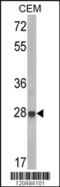 Insulin Like Growth Factor Binding Protein 6 antibody, 62-449, ProSci, Western Blot image 