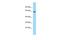 Eukaryotic Elongation Factor, Selenocysteine-TRNA Specific antibody, A12172, Boster Biological Technology, Western Blot image 