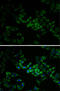 Adenylate Kinase 1 antibody, LS-C748509, Lifespan Biosciences, Immunofluorescence image 
