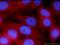 Synaptosome Associated Protein 23 antibody, 10825-1-AP, Proteintech Group, Immunofluorescence image 