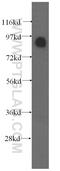 Oxysterol Binding Protein antibody, 11096-1-AP, Proteintech Group, Western Blot image 