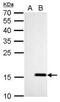 NME/NM23 Nucleoside Diphosphate Kinase 4 antibody, PA5-78081, Invitrogen Antibodies, Western Blot image 