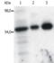 FYN Proto-Oncogene, Src Family Tyrosine Kinase antibody, LS-B1876, Lifespan Biosciences, Immunoprecipitation image 