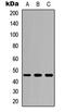 Colony Stimulating Factor 2 Receptor Alpha Subunit antibody, abx121565, Abbexa, Western Blot image 