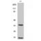 Caspase 6 antibody, LS-C380452, Lifespan Biosciences, Western Blot image 