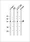 Ectonucleoside triphosphate diphosphohydrolase 2 antibody, GTX03639, GeneTex, Western Blot image 