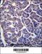 Transmembrane 9 superfamily member 2 antibody, 56-885, ProSci, Immunohistochemistry paraffin image 