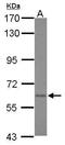 Asparagine Synthetase (Glutamine-Hydrolyzing) antibody, GTX103569, GeneTex, Western Blot image 