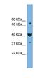 VPS16 Core Subunit Of CORVET And HOPS Complexes antibody, orb330939, Biorbyt, Western Blot image 