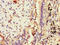 Signal Transducer And Activator Of Transcription 2 antibody, LS-C679659, Lifespan Biosciences, Immunohistochemistry paraffin image 
