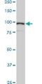 Actinin Alpha 4 antibody, H00000081-M01, Novus Biologicals, Western Blot image 