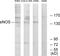 Nitric Oxide Synthase 3 antibody, LS-C118001, Lifespan Biosciences, Western Blot image 