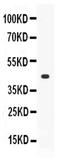 Thyroid Peroxidase antibody, PA5-80124, Invitrogen Antibodies, Western Blot image 