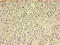 ARF6-Specific antibody, LS-C369258, Lifespan Biosciences, Immunohistochemistry paraffin image 