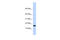 Egl-9 Family Hypoxia Inducible Factor 2 antibody, 25-225, ProSci, Western Blot image 