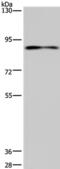 Cyclic Nucleotide Gated Channel Alpha 3 antibody, PA5-50211, Invitrogen Antibodies, Western Blot image 