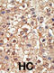 Protein Inhibitor Of Activated STAT 4 antibody, abx026852, Abbexa, Immunohistochemistry paraffin image 