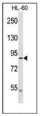 Dynein Axonemal Heavy Chain 2 antibody, AP51283PU-N, Origene, Western Blot image 