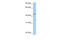 Patatin Like Phospholipase Domain Containing 5 antibody, 26-369, ProSci, Western Blot image 