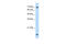 Ubiquitin Conjugating Enzyme E2 L3 antibody, 29-823, ProSci, Western Blot image 