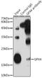 Phospholipid hydroperoxide glutathione peroxidase, mitochondrial antibody, GTX54095, GeneTex, Immunoprecipitation image 