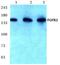 Fibroblast Growth Factor Receptor 2 antibody, AP06119PU-N, Origene, Western Blot image 