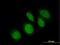 RB Binding Protein 9, Serine Hydrolase antibody, H00010741-B01P, Novus Biologicals, Immunofluorescence image 